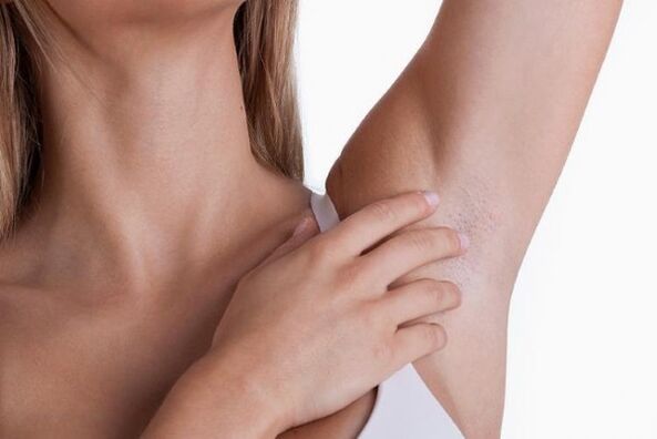 papillomer under armhulerne på en kvinde
